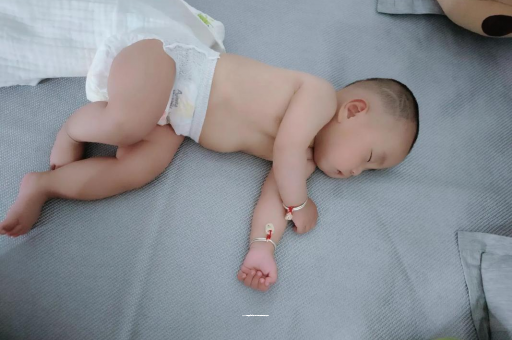 南昌六个月宝宝眼睛散光